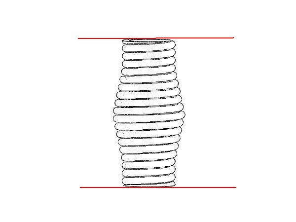 Adlers Nest 1/35 WWII US Army Antenna Base and Cap AS-3916 US | 4582278203285